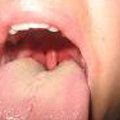 Bad Breath Cures