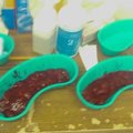 tonsil stones removal, removing tonsil stones, how to remove tonsil stones