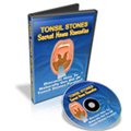 tonsilstonesremedies,review,tonsil stones remedies, tonsil stones treatment,removing tonsil stones,prevent tonsil stones