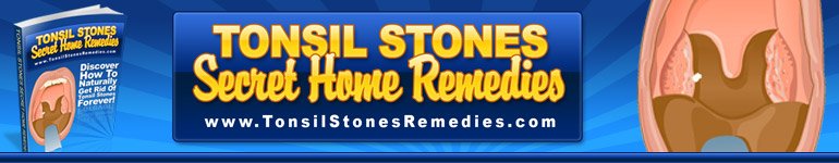 Tonsil Stones Secret Home Remedies Tonsil Stones Secret Home Remedies
