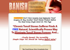 banish tonsil stones