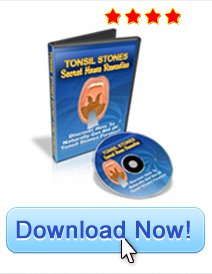 Tonsil Stone Secret Home Remedies Tonsil Stone Secret Home Remedies