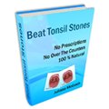 Beat tonsil stones eBook