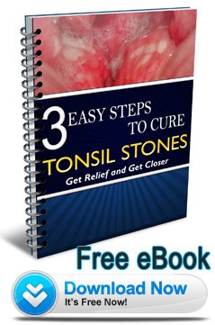 Cure Tonsil Stones