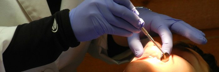 Treatment for Tonsil Stones