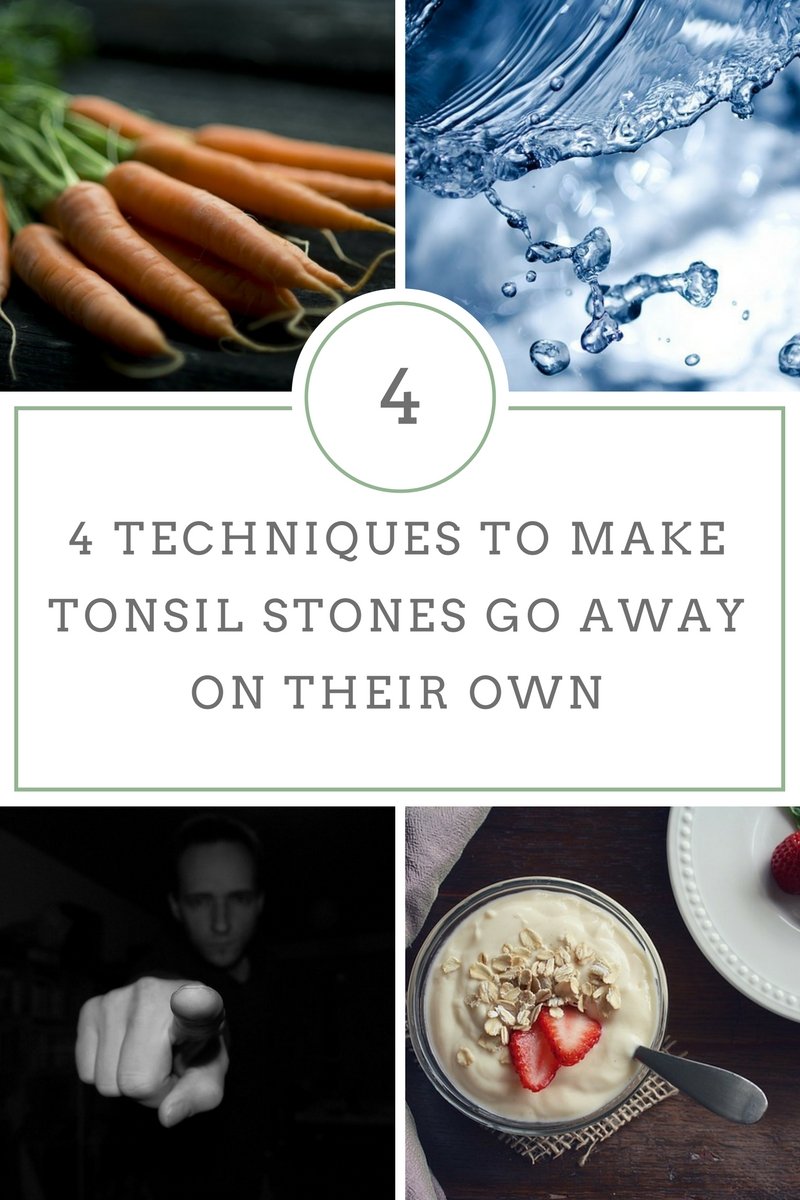 4 Techniques to make tonsil stones go away on their own